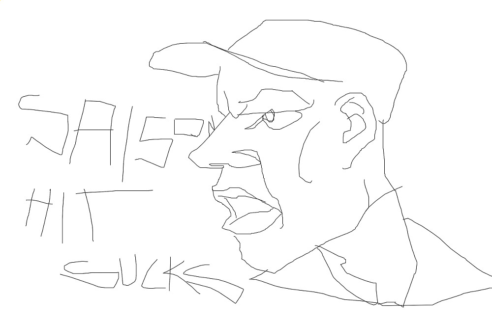 sucks