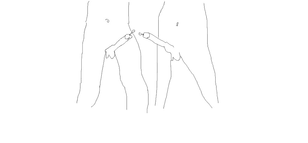 black sperm